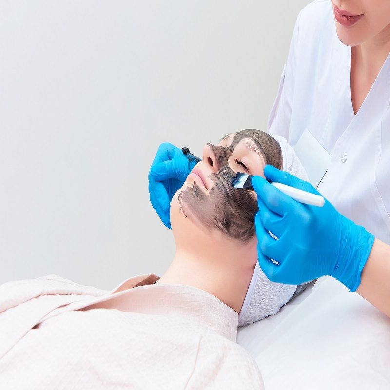 Carbon peeling of the face of a young woman in a clinic.